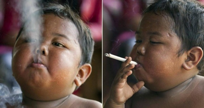 Cet enfant de 2 ans fumait 40 cigarettes par jour, voici à quoi il ressemble aujourd'hui